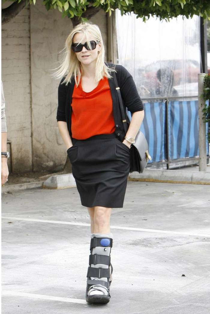 How Did Reese Witherspoon Break Her Leg