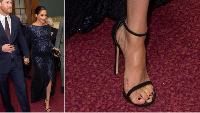 Celebrities With Bunions Surgery