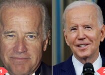 Joe Biden Plastic Surgery Before & After