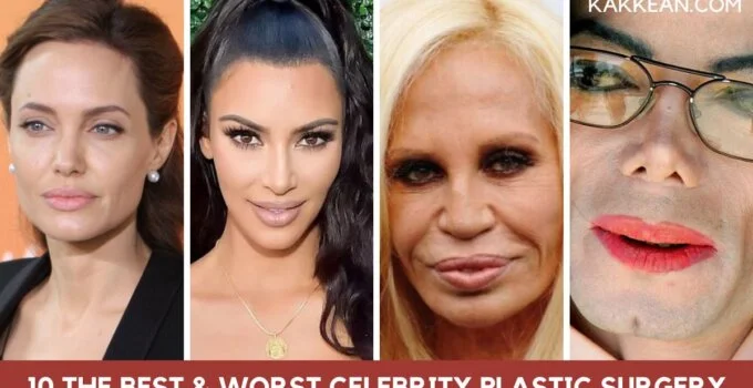 The Best and Worst Celebrity Plastic Surgery