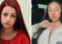 Bhad Bhabie Plastic Surgery Before & After