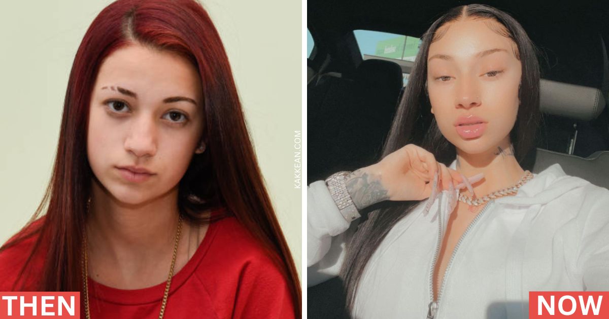 Bhad Bhabie's Plastic Surgery Before & After