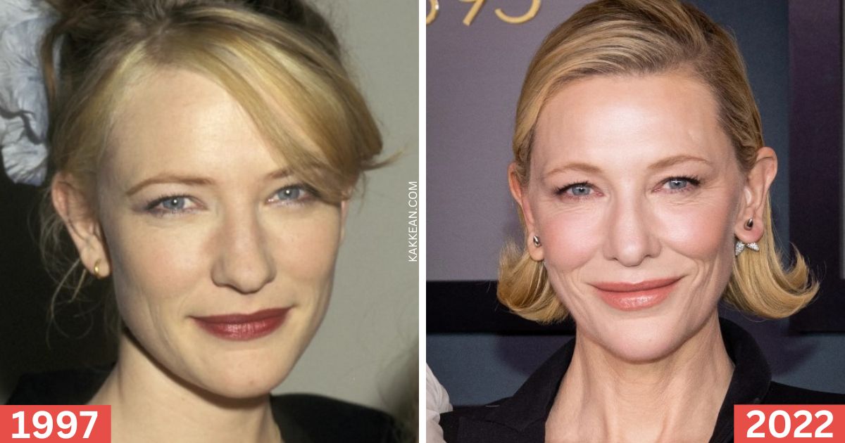 Cate Blanchett's Plastic Surgery