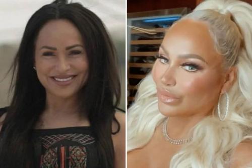 Darcey Silva Plastic Surgery Before and After