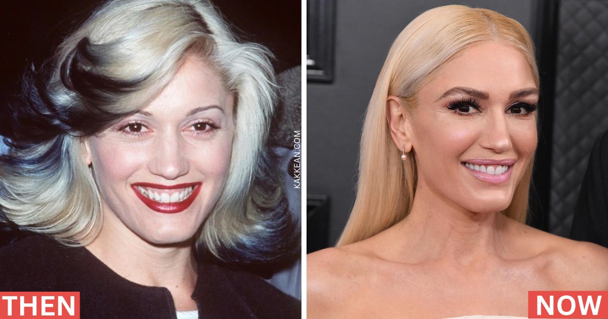 Gwen Stefani Before & After