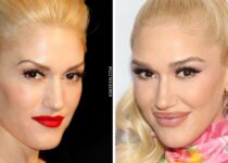 Gwen Stefani Plastic Surgery Before & After