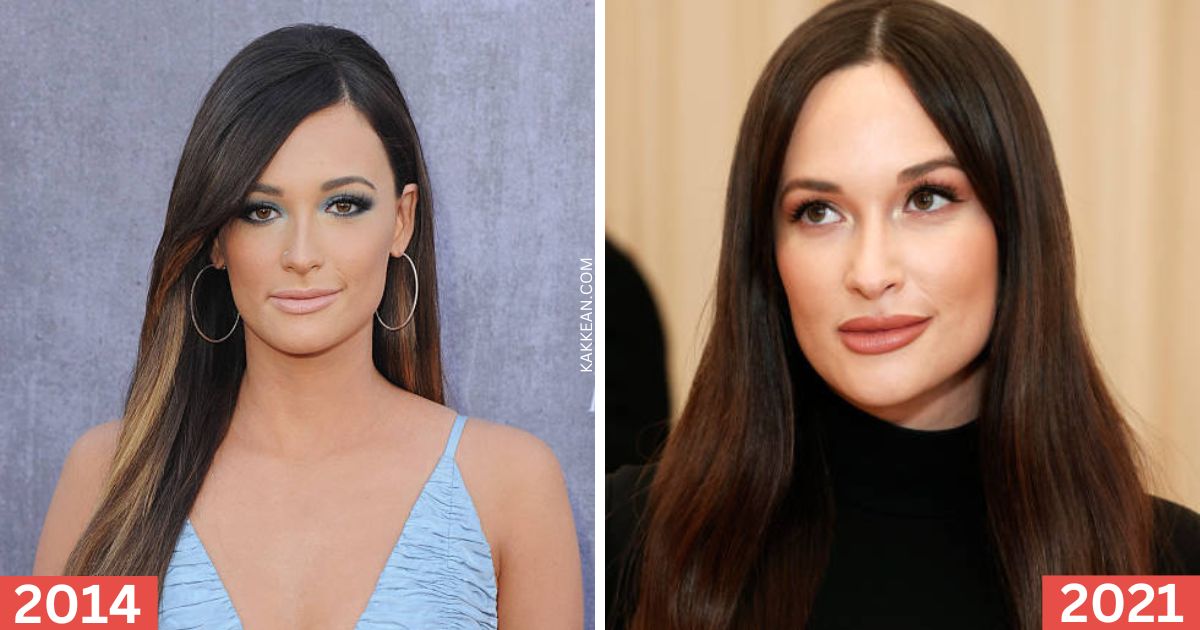 Kacey Musgraves Before & After