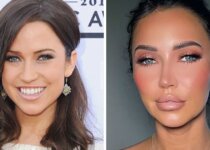 Kaitlyn Bristowe Plastic Surgery Before & After