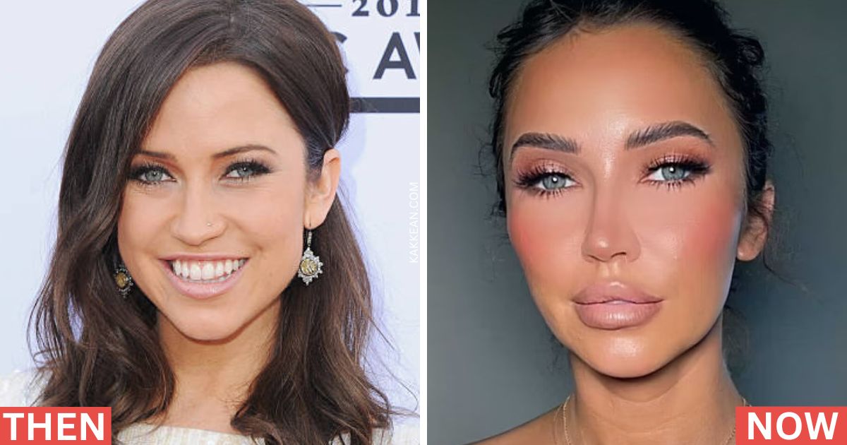 Kaitlyn Bristowe Plastic Surgery Before & After