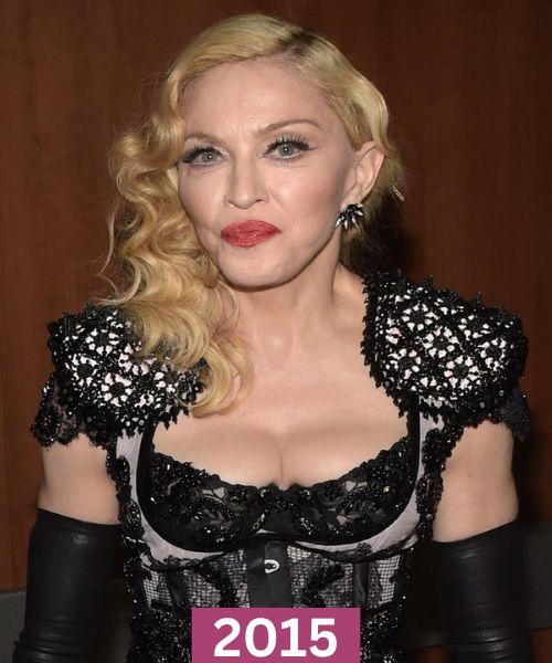 Madonna 2015
