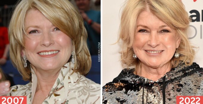 Martha Stewart Plastic Surgery Before & After