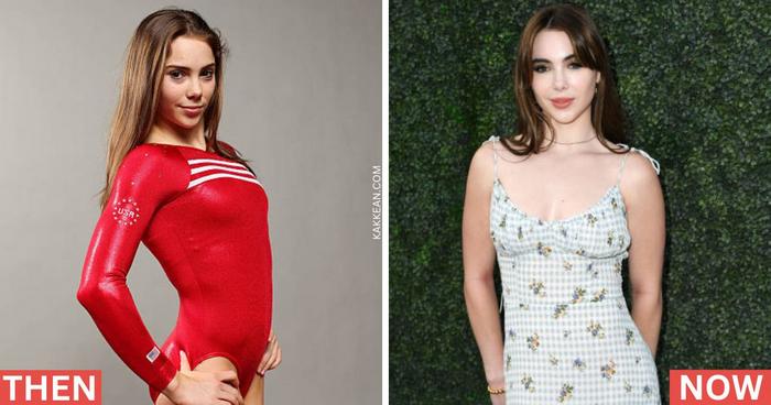 McKayla Maroney Plastic Surgery Before & After