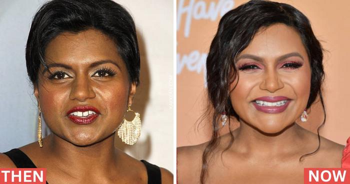 Mindy Kaling Before and After