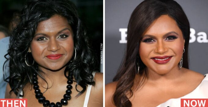 Mindy Kaling Plastic Surgery Before & After