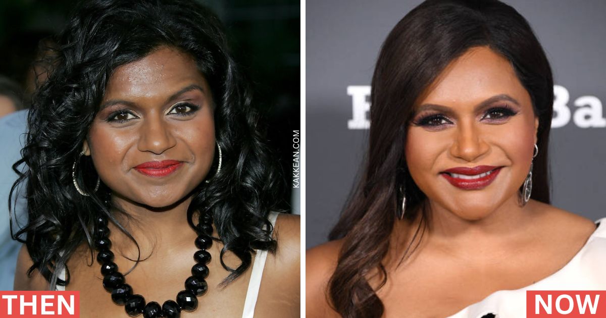 Mindy Kaling Plastic Surgery Before & After
