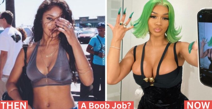 Saweetie Plastic Surgery Before & After