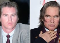 Val Kilmer's Plastic Surgery Before & After