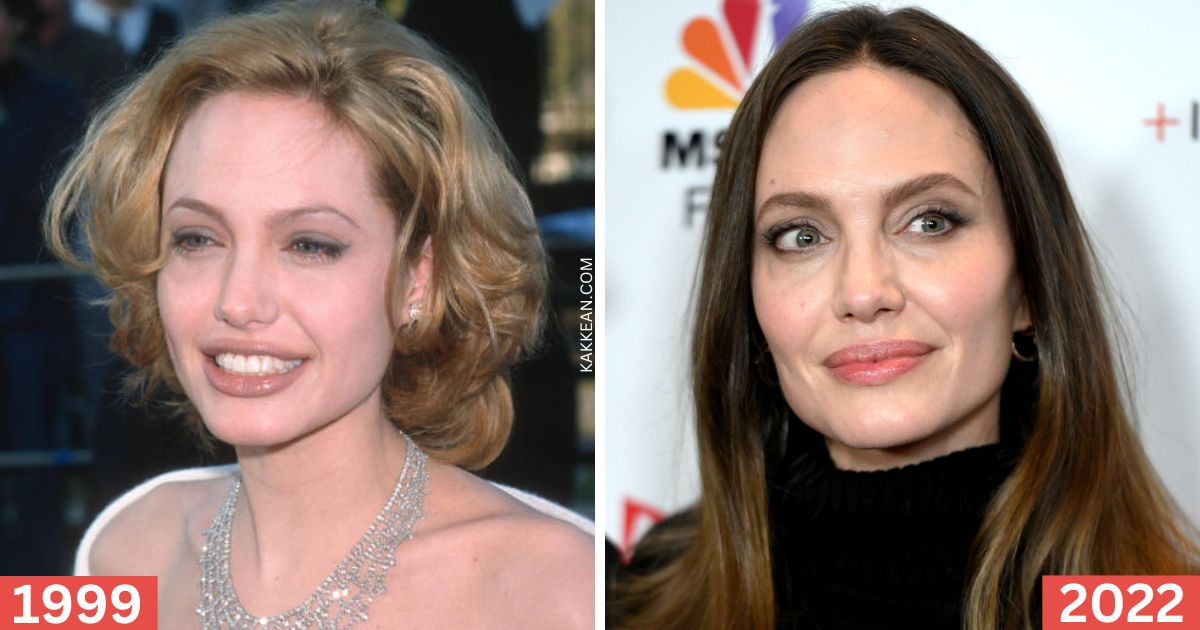 Angelina Jolie Plastic Surgery Before & After