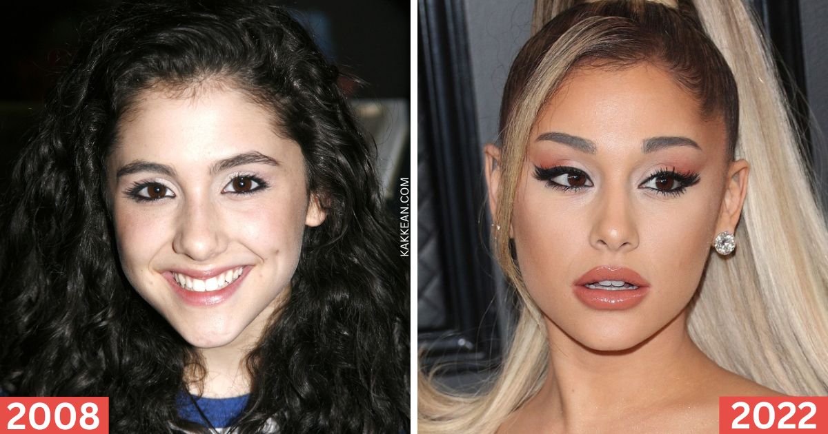 Ariana Grande Plastic Surgery Before & After