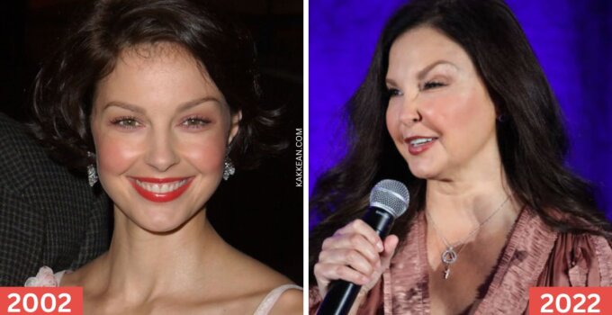 Ashley Judd Plastic Surgery Before & After