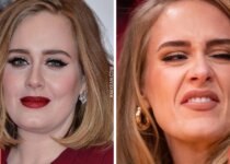 Adele's Plastic Surgery Before After