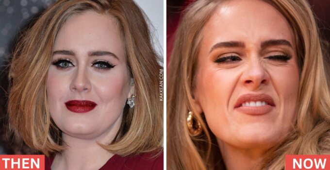 Adele's Plastic Surgery Before After