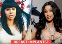 Cardi Bs Plastic Surgery Before and After
