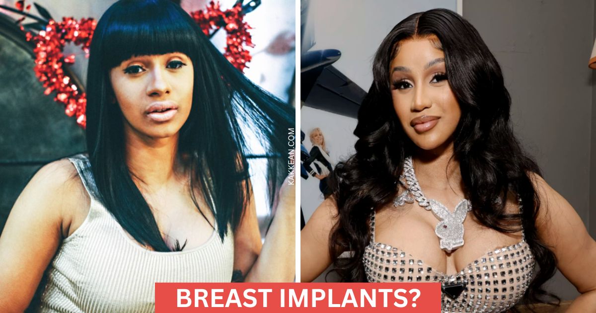 Cardi B's Plastic Surgery Before and After