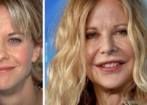 Meg Ryan's Plastic Surgery Before & After