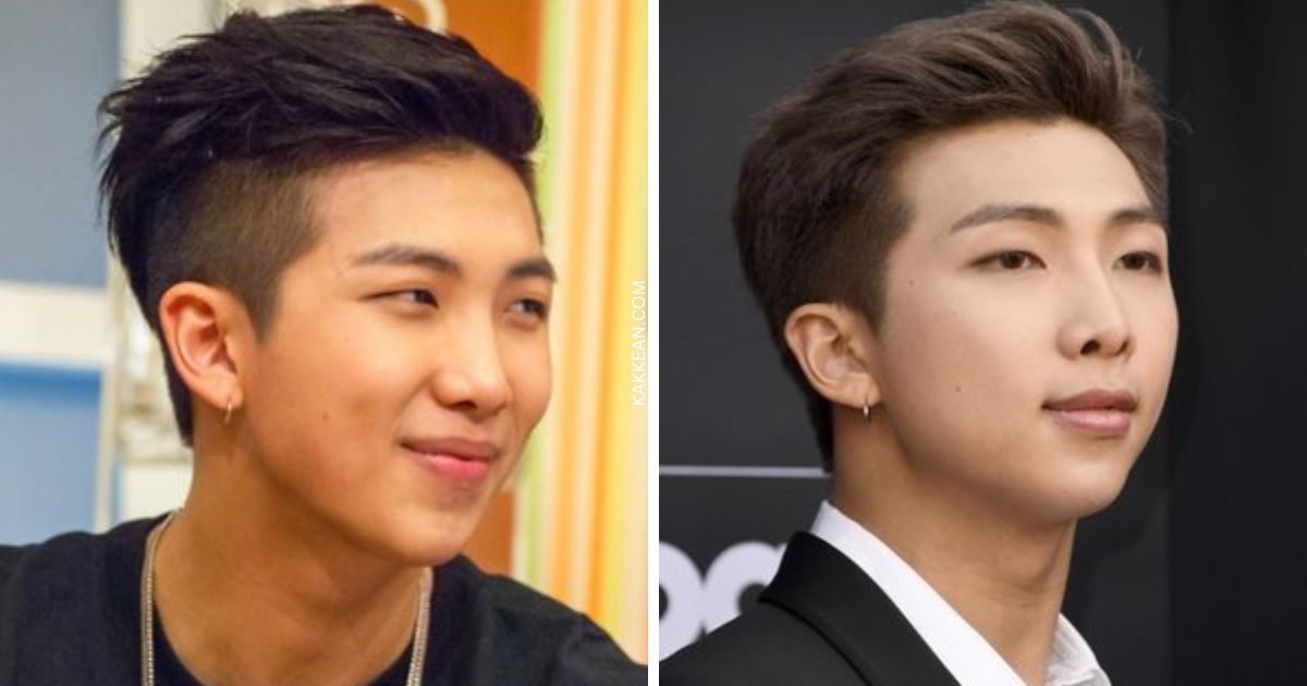 BTS Plastic Surgery Before & After