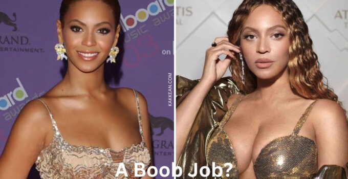 Beyoncé Plastic Surgery Before & After