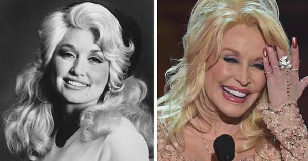 Dolly Parton Plastic Surgery Before & After
