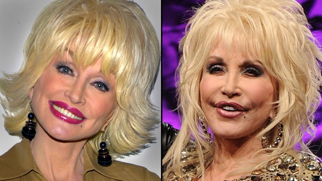Dolly Parton Then & Now