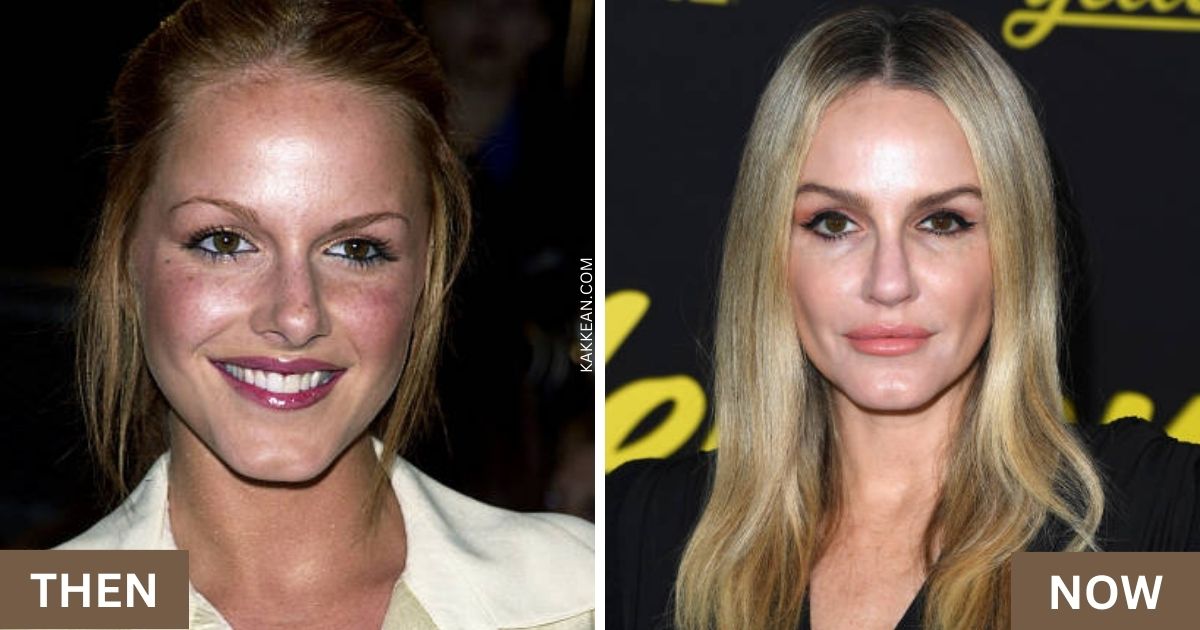 Monet Mazur Plastic Surgery Before & After