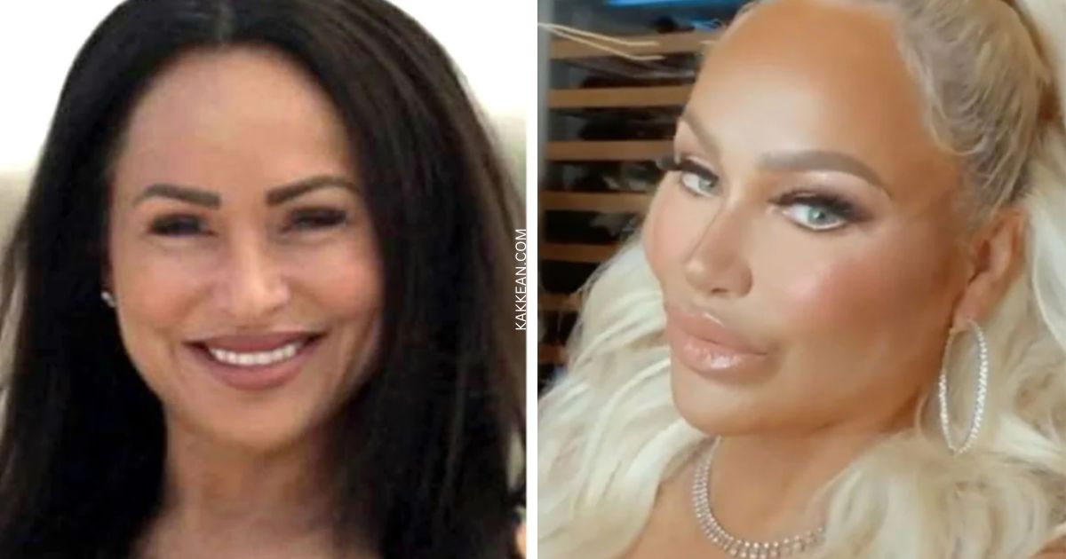 Stacey Plastic Surgery
